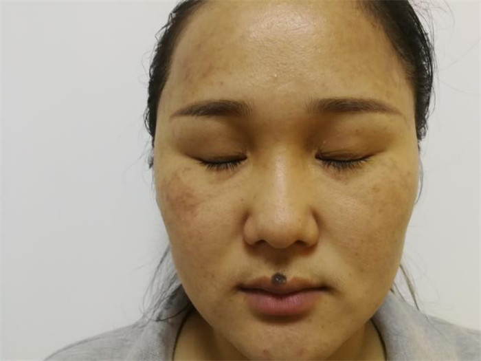Treatment result pictures (12)