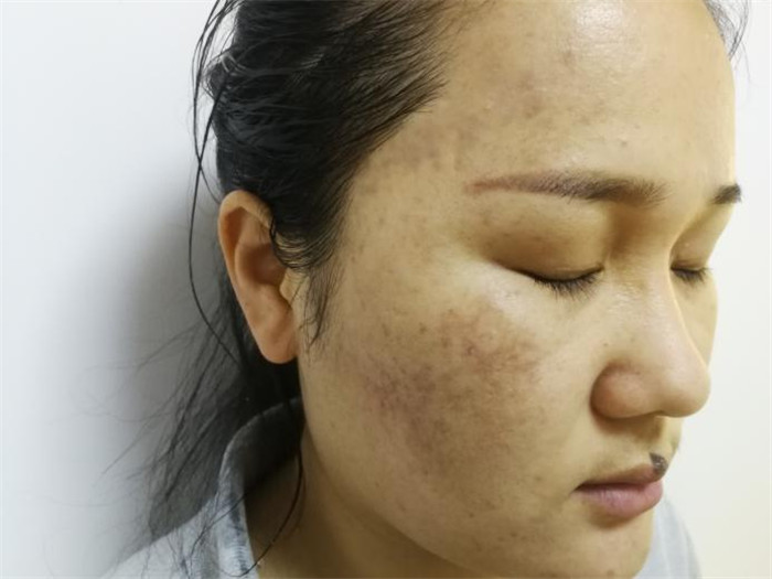 Treatment result pictures (13)