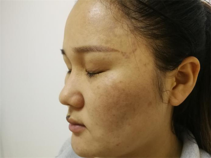 Treatment result pictures (14)