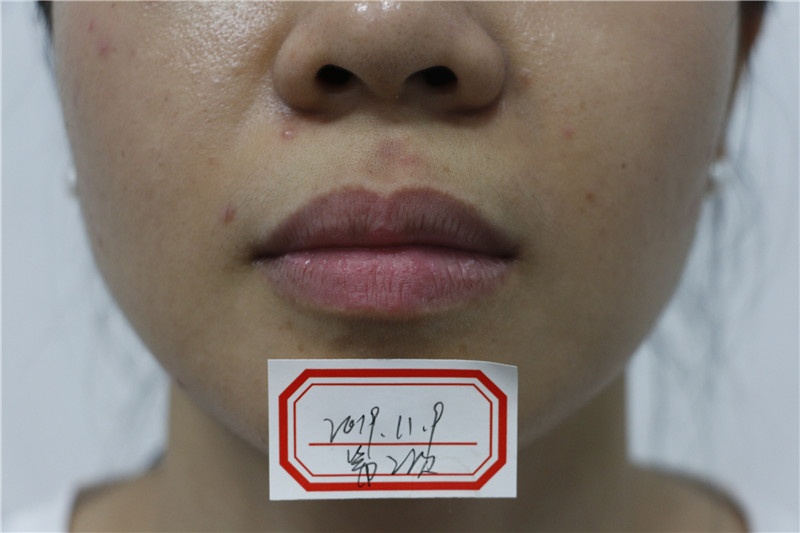 Treatment result pictures (1)
