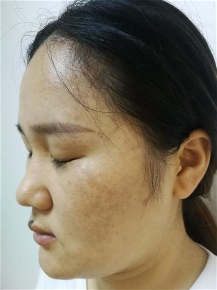 Treatment result pictures (6)