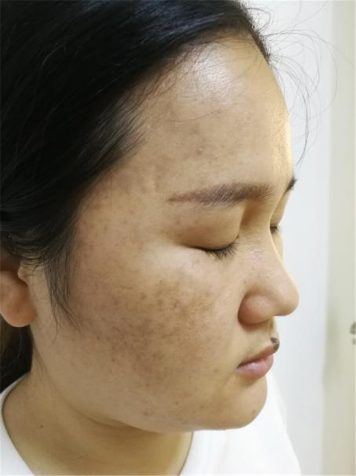 Treatment result pictures (7)