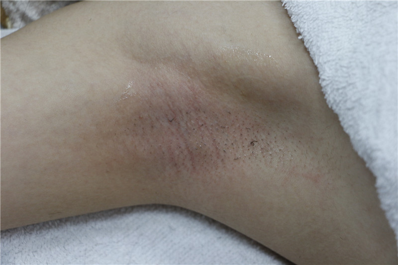 Treatment result pictures (9)