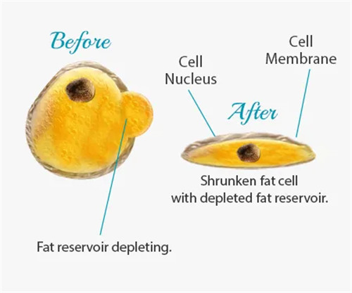 fat reduction