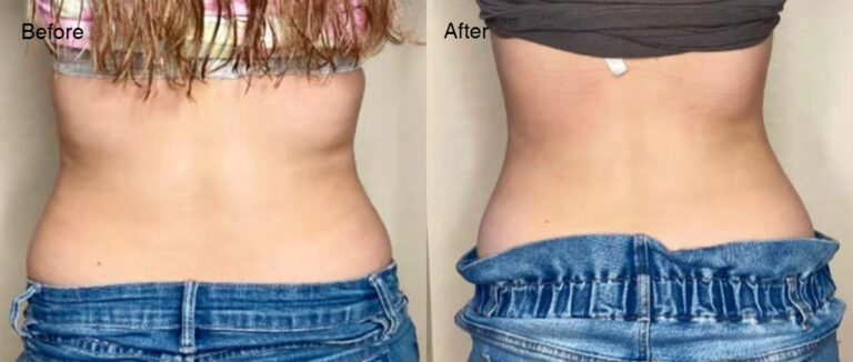 Cavitation Lipo 3 2 26