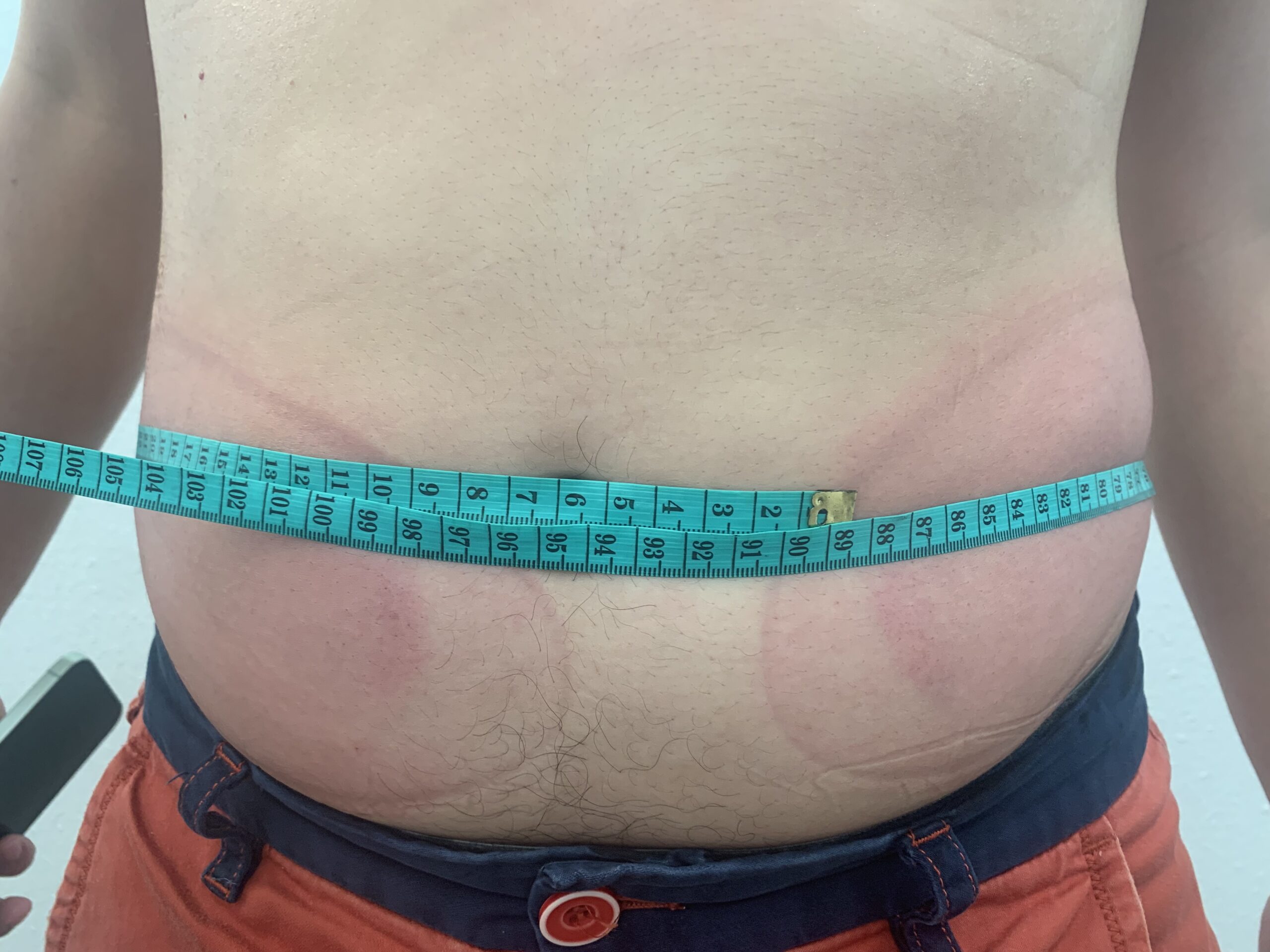 Cryo Therapy 9 Img 1671.Heic Scaled