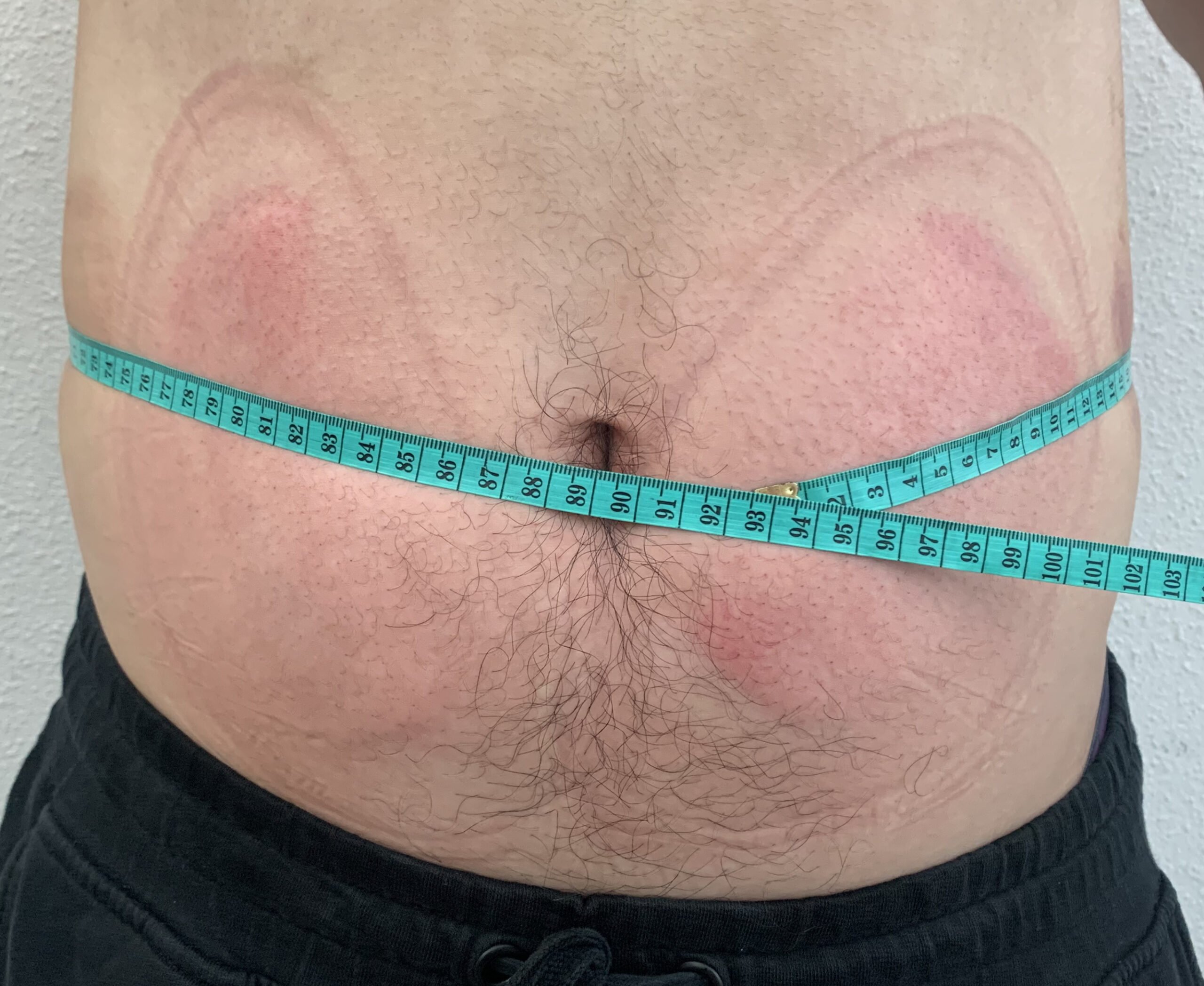 Cryo Therapy 13 Img 1685.Heic Scaled
