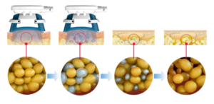 Blog 7 Cryo 2