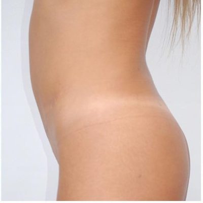 Abs4